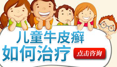 红皮型牛皮癣治疗有哪些有效的方法