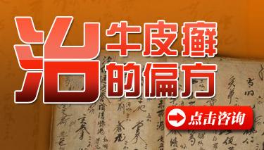 治疗牛皮癣的最好偏方是什么