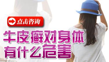 红皮病型牛皮癣患者用药要注意什么