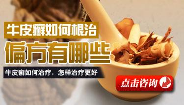 在春季牛皮癣患者如何预防病情反复